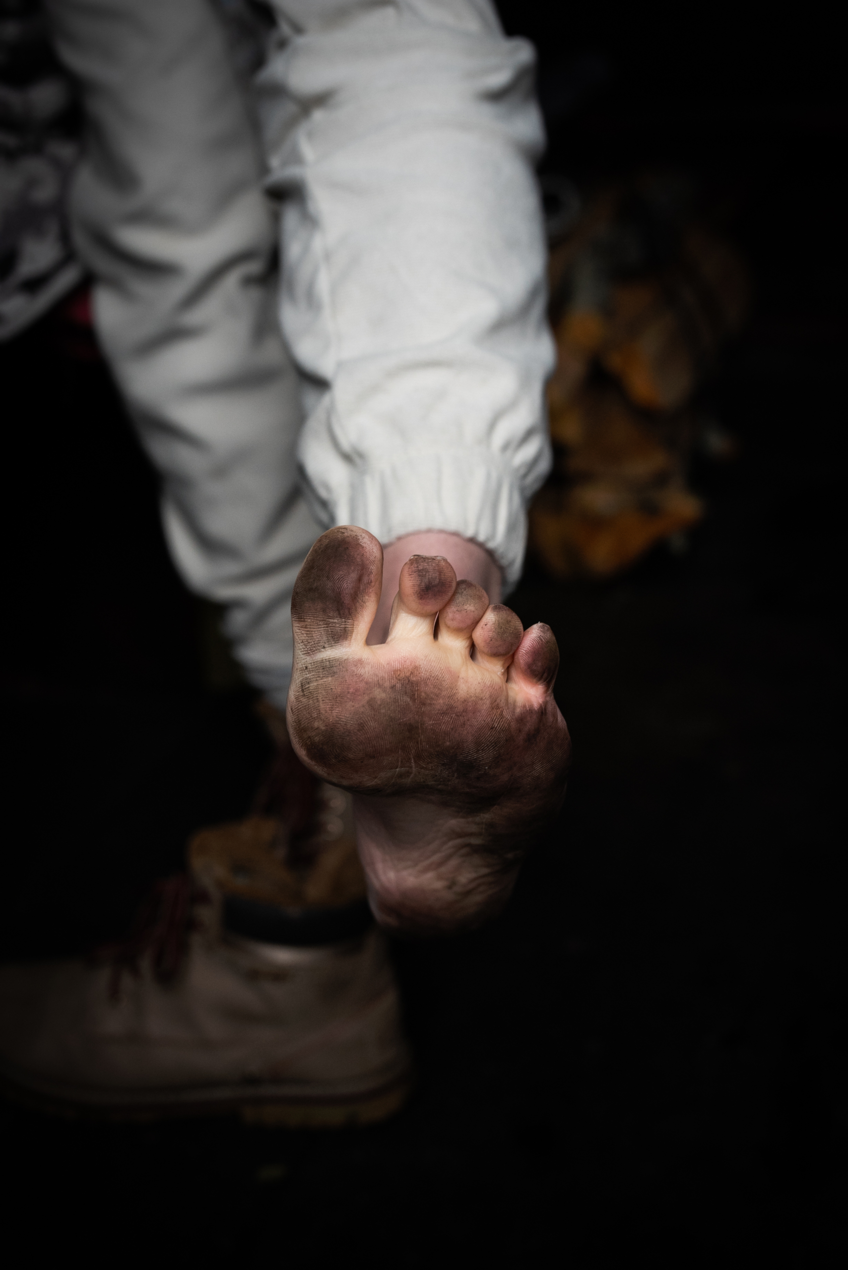 jalad võivad mustaks saada